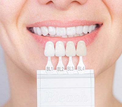 Veneers Veneers